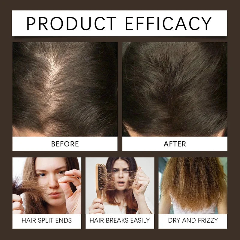 Biotin Fast Hair Growth Spray Anti Hair Loss Serum Prevent Baldness Treatment Scalp Beard Beauty Essence Hair Care Products 30ml